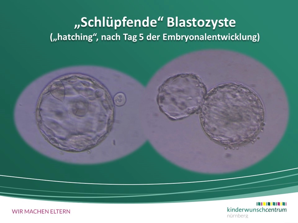 pflanztopf kunststoff anthrazit Pflanztopf Set „Egg“ Serie Stone – Blumentöpfe rund aus recyceltem  Kunststoff Anthrazit oder Sand main image 1