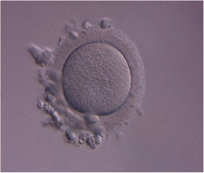 Unbefruchtete Eizelle, Kinderwunschcentrum Nürnberg