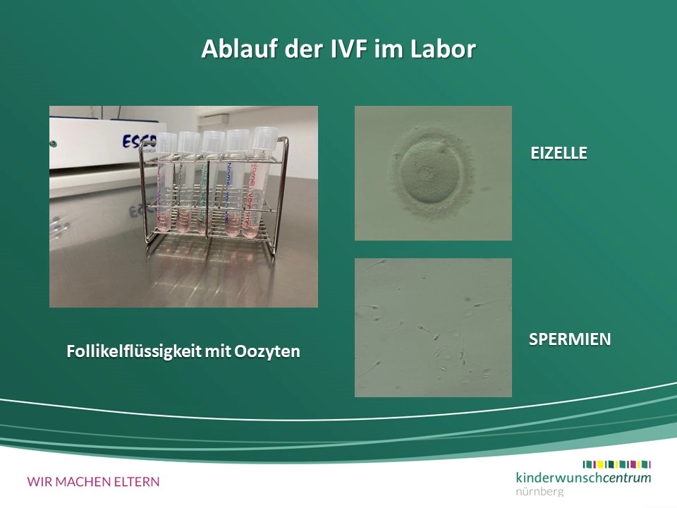 In-vitro-Fertilisation (IVF)